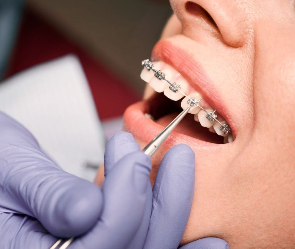 implant courses for general dentists