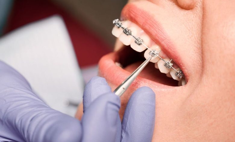 implant courses for general dentists