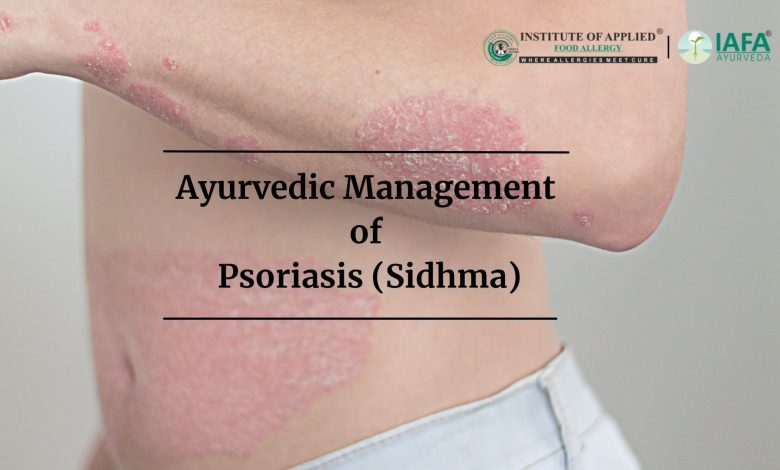 Ayurveda Treat Psoriasis