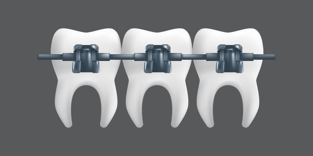 Braces Penang