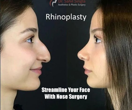 rhinoplasty
